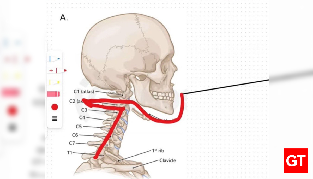 FBI Confirms Charlie Kirk was Killed by the Same ‘Magic Bullet’ that Killed JFK